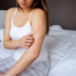Allergies punaises de lit : symptômes, causes et solutions efficaces